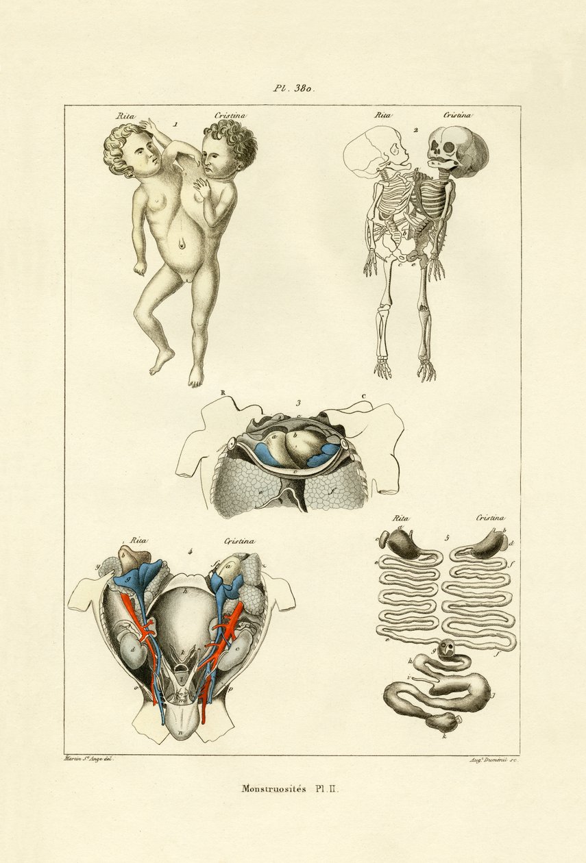 怪胎，1833-39 作者 法语学校