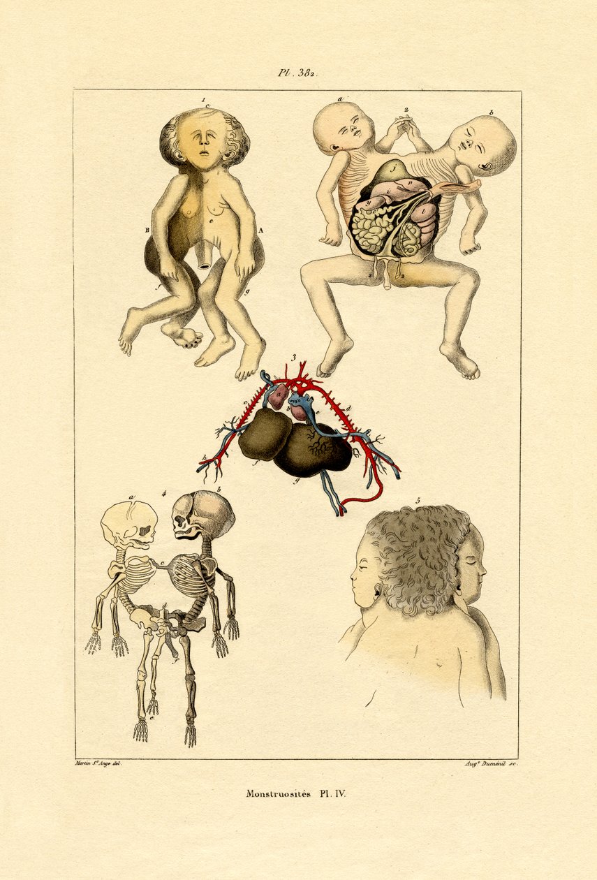 怪胎，1833-39 作者 法语学校